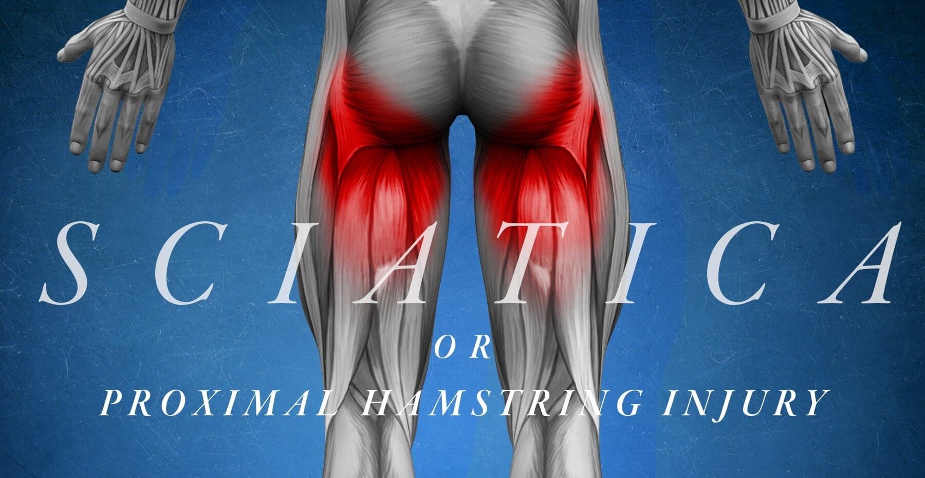 Músculos de la parte posterior de la pierna identificados